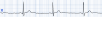 Cas clinique miniature