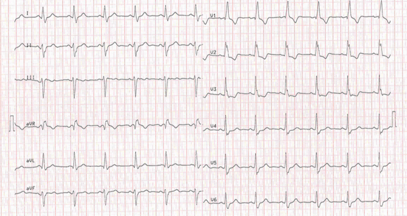 Fichier:Capture d’écran 2023-06-30 à 23.11.31.png