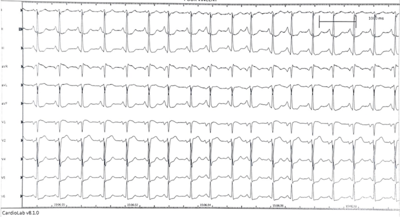 Fichier:Capture d’écran 2023-06-30 à 23.23.41.png