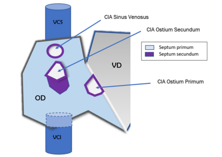 Graphviz Editor Windows