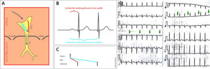 Fichier:Figure 2 - Double réponse.jpg