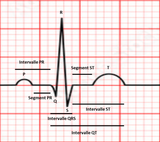 Fichier:ECG - intervalles et segments.png