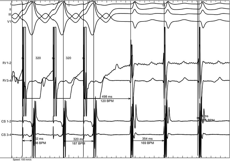 Fichier:Figure 16 - ppi vav sava.jpg