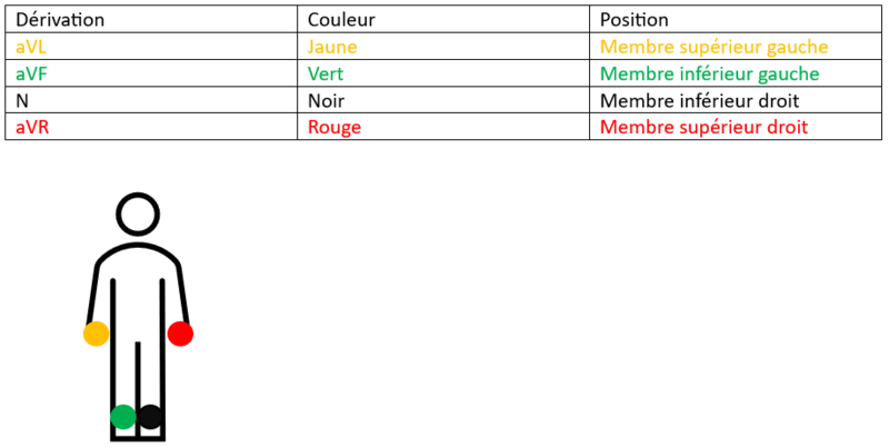 Fichier:Positions des électrodes pour les dérivations frontales.png