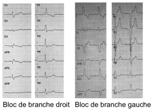 Bloc de branche